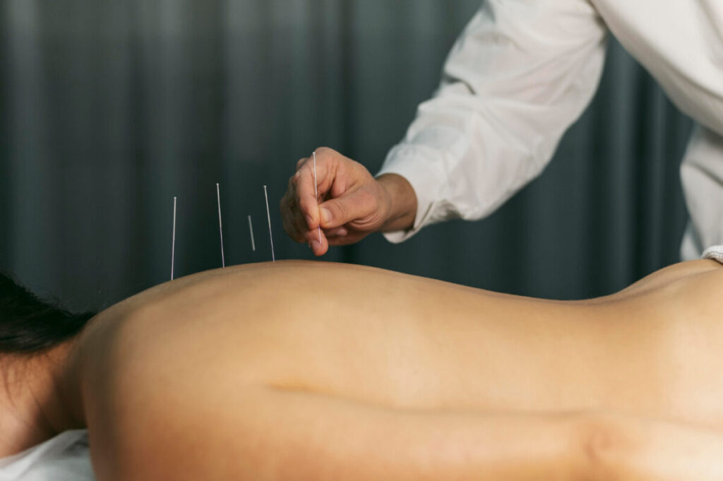 Cum să alegi cabinetul de acupunctură potrivit: ghid pentru pacienții interesați de terapia holistică