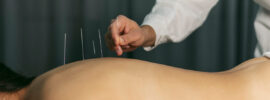 Cum să alegi cabinetul de acupunctură potrivit: ghid pentru pacienții interesați de terapia holistică