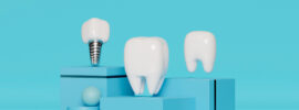Implantul dentar rapid