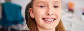 Beneficiile aparatului dentar la copii
